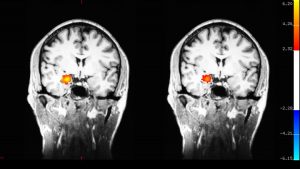 brain